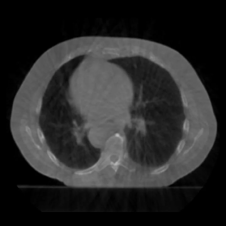 Input cone-beam CT, chest