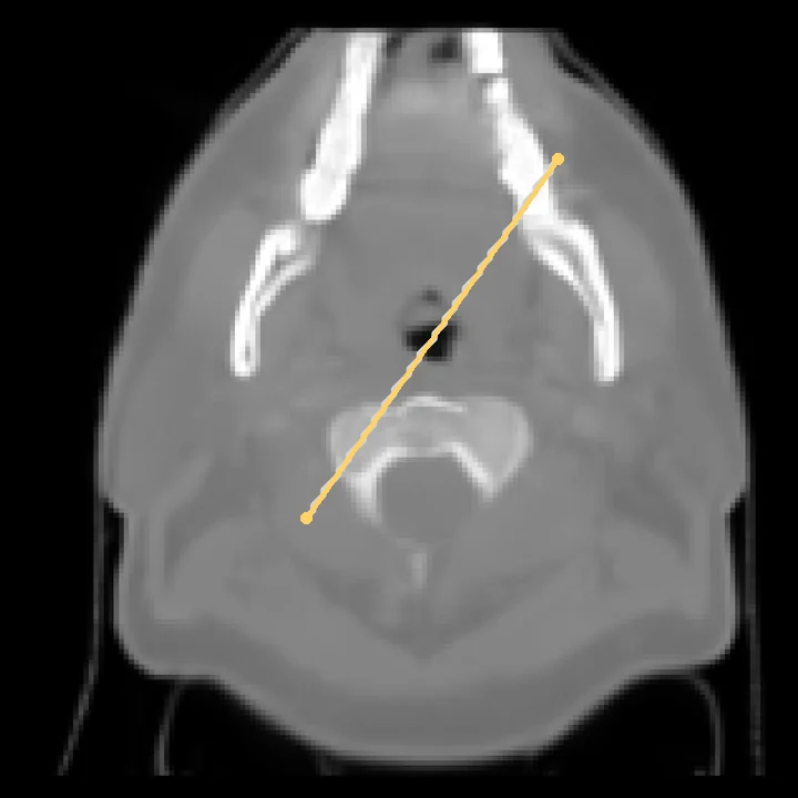 CT generated by RadWorld from the MR, with the profile line marked