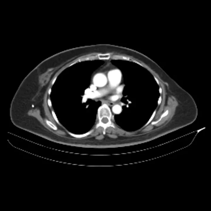Real arterial-phase CT of the same patient, aligned to the input